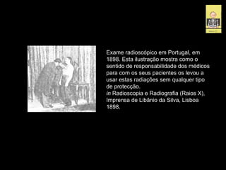 Exame radioscópico em Portugal, em
1898. Esta ilustração mostra como o
sentido de responsabilidade dos médicos
para com os seus pacientes os levou a
usar estas radiações sem qualquer tipo
de protecção.
in Radioscopia e Radiografia (Raios X),
Imprensa de Libânio da Silva, Lisboa
1898.
 