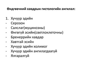 Өндгөвчний хавдрын гистологийн ангилал:
1. Хучуур эдийн
- Серозон
- Салслаг(муцинозны)
- Өнгөгүй эсийн(светлоклеточны)
- Бренеррийн хавдар
- Хавтгай эсийн
- Хучуур эдийн холимог
- Хучуур эдийн ангилагдаагүй
- Ялгаралгүй
 