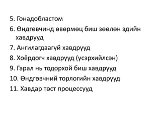 5. Гонадобластом
6. Өндгөвчинд өвөрмөц биш зөөлөн эдийн
хавдрууд
7. Ангилагдаагүй хавдрууд
8. Хоёрдогч хавдрууд (үсэрхийлсэн)
9. Гарал нь тодорхой биш хавдрууд
10. Өндгөвчний торлогийн хавдрууд
11. Хавдар төст процессууд
 