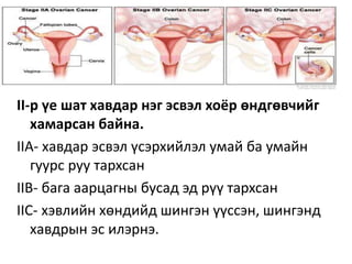 II-р үе шат хавдар нэг эсвэл хоёр өндгөвчийг
хамарсан байна.
IIА- хавдар эсвэл үсэрхийлэл умай ба умайн
гуурс руу тархсан
IIВ- бага аарцагны бусад эд рүү тархсан
IIС- хэвлийн хөндийд шингэн үүссэн, шингэнд
хавдрын эс илэрнэ.
 