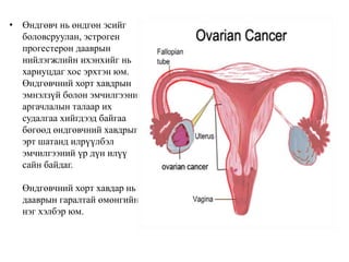 Ondgovchnii havdar | PPT
