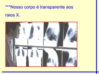 ***Nosso corpo é transparente aos  raios X. 