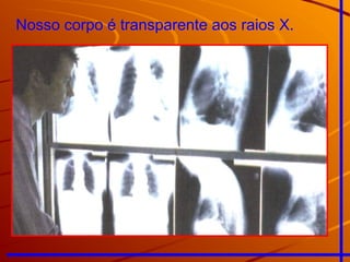 Nosso corpo é transparente aos raios X.
 