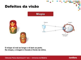 Ciências Fisico-Químicas 8.º ano — Universo da Matéria
Defeitos da visão
Miopia
O míope vê mal ao longe e vê bem ao perto.
Na miopia, a imagem é focada à frente da retina.
 