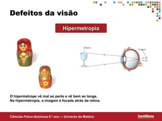 Ciências Fisico-Químicas 8.º ano — Universo da Matéria
Defeitos da visão
Hipermetropia
O hipermetrope vê mal ao perto e vê bem ao longe.
Na hipermetropia, a imagem é focada atrás da retina.
 