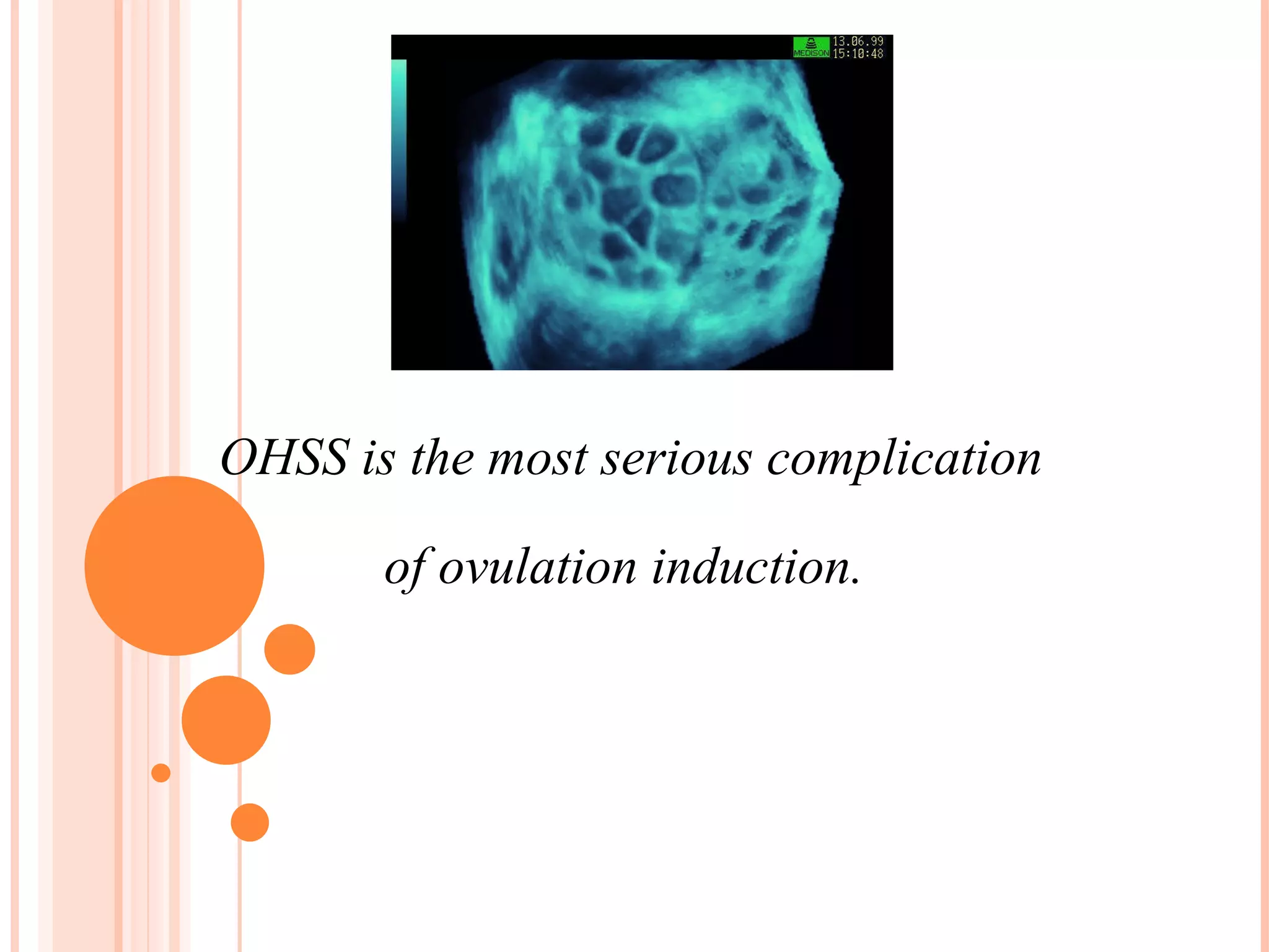 OHSS is the most serious complication  of ovulation induction. 