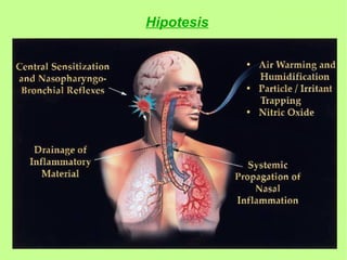 Hipotesis
 