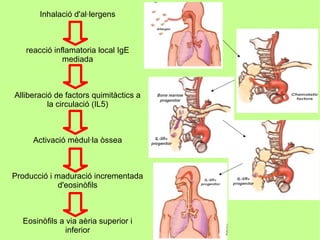 Inhalació d'al·lergens



   reacció inflamatoria local IgE
              mediada



Alliberació de factors quimitàctics a
          la circulació (IL5)



     Activació mèdul·la òssea



Producció i maduració incrementada
             d'eosinòfils



  Eosinòfils a via aèria superior i
               inferior
 
