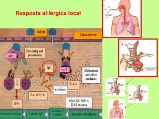 Resposta al·lèrgica local
 