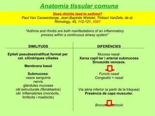 Anatomia tissular comuna
                          Does rhinitis lead to asthma?
         Paul Van Cauwenberge, Jean-Baptiste Watelet, Thibaut VanZele, de al.
                           Rhinology, 45, 112-121, 2007

           “Asthma and rhinitis are both manifestations of an inflammatory
                    process within a continuous airway system”


             SIMILITUDS                                  DIFERÈNCIES

Epiteli pseudoestratificat format per                   Mucosa nasal:
       cel. cilíndriques ciliades            Xarxa capil·lar i arterial submucosa
                                                    Sinusoids venosos.
          Membrana basal

              Submucosa:                                 Funció nasal
             vasos sanguinis                           Congestió = nasal
                  nervis
           glándules mucoses
     cèl estructurals (fibroblastos)        Via aèria inferior (a partir de la tràquea)
     cèl. Inflamatòries (monòcits,              Presència de capa muscular.
          limfòcits i mastòcits)

                                                       Broncoconstricció
 