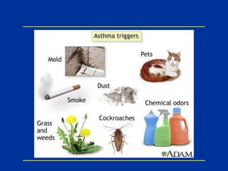 ARIA Guidelines:
Recommendations for
Management of Allergic
Rhinitis
2012
 