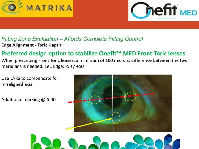 ONE FIT SCLERAL LENS.ppt | Eye and Vision Conditions | Diseases and ...