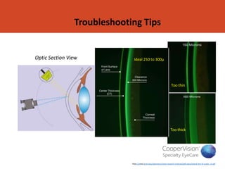 ONE FIT SCLERAL LENS.ppt