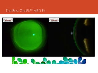 ONE FIT SCLERAL LENS.ppt
