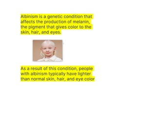 Albinism is a genetic condition that
affects the production of melanin,
the pigment that gives color to the
skin, hair, and eyes.
As a result of this condition, people
with albinism typically have lighter
than normal skin, hair, and eye color
 