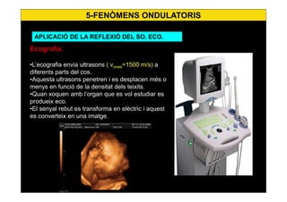 5-FENÒMENS ONDULATORIS
APLICACIÓ DE LA REFLEXIÓ DEL SO. ECO.
Ecografia:
•L’ecografia envia ultrasons ( vones=1500 m/s) a
diferents parts del cos.
•Aquesta ultrasons penetren i es desplacen més o
menys en funció de la densitat dels teixits.
•Quan xoquen amb l’organ que es vol estudiar es
produeix eco.
•El senyal rebut es transforma en elèctric i aquest
es converteix en una imatge.
 