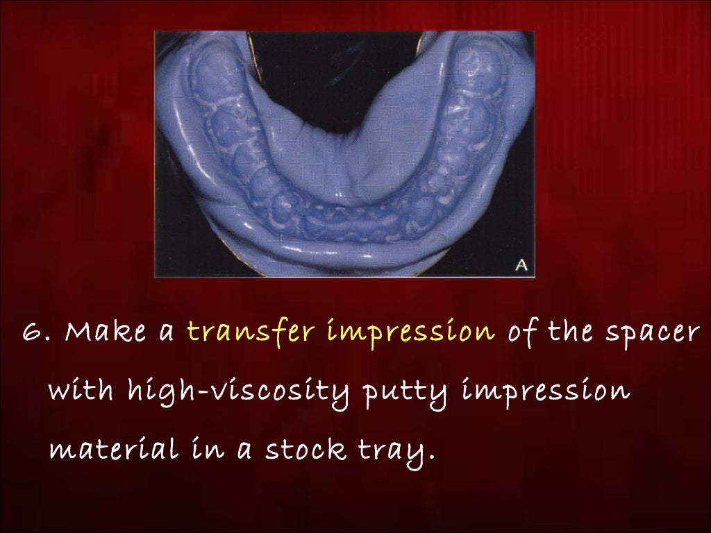 Modified One Step Putty Wash Technique