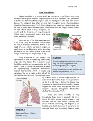 Lung Transplants<br />32004001292225Organ transplant is a surgery which we remove an organ from a donor and donate to the recipient. The first lung transplant on human happened 1963, performed by Hardy. The donation of the lung was from the dead person who died from cardiac disease. The recipient died after 18 days from transplant (Lung Transplantation: EMedicine Transplantation, 2010). The medication and treatment has improved over the past 50 years, which allowed higher survivability after the surgery. In this essay it will talk about what is lung transplant, the benefit and the limitation of lung transplant, ethical issues, economical issues, and social issues about lung transplant.<br />Diagram 1Heart-lung bypass machine is used to keep the blood oxygenated and circulating during the surgery.(Lung Transplant - Series: MedlinePlus Medical Encyclopedia, 2010)Lungs are one of the fatal organs we need in our body. Lungs are in charge of controlling the amount of oxygen and carbon dioxide in our blood. When we inhale, we take in oxygen and supply them to the blood and when we exhale we breathe out the carbon dioxide in the blood. (Lungs: Pulmonary and Respiratory, 2010)<br />Lung transplant is the surgery that replaces one or both diseased lungs with healthy lungs from the donor. The recipient’s tissue should be matching as close as possible with the donor’s tissue to reduce the possibility of donor cell rejection (Lung Transplant: MedlinePlus Medical Encyclopedia, 2010). In single lung transplant, the cut is made on the side of the chest of the diseased lung. The operation takes up to 4 to 8 hours. In double lung transplant, the cut is made below the chest. The surgery takes up to 6 to 12 hours. During the double lung transplant, a special machine is used to provide oxygen and move blood through the body (See diagram 1) (Lung Transplant: MedlinePlus Medical Encyclopedia, 2010). <br />Diagram 2Diagram of lungs (Health Library, 2010)101600-819785There are some benefits to lung transplants. First, there is possibility to live a longer life after getting severe diseases. Lung diseases such as cystic fibrosis (causing thick mucus to build up in lungs, see diagram 2) can lead to early death. However, if we remove the diseased lungs and transplant healthy lungs, there is possibility to live longer than expected (Lung Transplant: MedlinePlus Medical Encyclopedia, 2010). <br />Another benefit of lung transplant is people can become more energetic, and more active. For people who were born with small sized lung can also take lung transplant to increase the size of their lung. If they increase the size of their lung, more oxygen are inhaled which means more oxygen to oxygenate the blood. This can lead people to be more energetic and more active (TYPE HTML PUBLIC, 2010). <br />There are some limitations with lung transplants. Firstly there are risks of death during the surgery. If the patient has critical illness, disease that may affect the new lung, continuously involves in cigarette smoking and alcohol and drug addiction, possibility of cancer within two years, the person may die during the transplant or a short period of time after the surgery (Lung Transplant: MedlinePlus Medical Encyclopedia, 2010). <br />Second disadvantage is that there are possibilities of donor cell rejection. To suppress the immune system of the recipient from attacking the donor’s tissue the person has to continuously consume immunosuppressant drugs (Pulmonary Hypertension Association, 2010). If not the immune system will attack the new lungs and lead to necessity of removing the new lungs. <br />Another limitation is the survivability after the surgery. The survivability after the lung transplant surgery turns out to be very low compared to other transplants. According to statistic based on the data from 2006, about 85% of people who had lung transplant lived at least one year, 50% survived for 5 years and only 25% of the people who had lung transplant was able to survive for 10 years (Lung Transplantation-Wikipedia, 2010). <br />There are ethical issues with lung transplant. Lung transplant is said to be a surgery that prolongs one’s life and provide a better quality of life for desperately sick people. Many people believe it is ethical to do surgeries, which prolongs one’s life especially if it is fatal for one’s life (Chronic Respiratory Disease, 2010). <br />There are some economical issues with lung transplant surgeries. The lung transplant can be a great financial burden. The United Network for Organ Sharing has reported that for double lung transplants it can cost about $543,900. This includes organ procurement fee, hospital fee, physician fee, immunosuppressant drugs and more (Pulmonary Hypertension Association, 2010). Only the people who are high status in economy may be able to spend the money for the transplant surgery.<br />There are some social issues with lung transplant. Many people decide to take lung transplant because of desire for better conditions. However, there can be opposite effect with lung transplant. A soldier in UK called Matthew Millington, 31, died at his home in 2008 less than a year after his surgery of lung transplant. Less than a year, a tumor was found in the new lungs. Despite radiotherapy to cure the tumor, he died on February 8, 2008. It turned out to be he has received a smoker’s lungs that smoked up to 50 cigarettes a day (see picture 1). The hospital said that “Using lungs from donors 2941320-101600Picture 1X-ray picture of cigarette smoker’s lung (CNN.com, 2010)who have smoked in the past is not unusual” This was because if the hospital only persists to donate healthy lungs, a lot of people would die waiting for the lung transplant. The hospital said, “during the same period 84 people died on the waiting list”. (CNN.com, 2010) There may be opposite affect with lung transplant. If there are high demand and low supply people need to wait for another donor to approach.<br />Lung transplant is one of the transplants that have high demands and low supplies. The survivability rate after the surgery is low compared to other organ transplant. There are possibilities of side affects with immunosuppressant. The cost of the transplant is expensive because of the success rate of the transplant. There are possibility of longer life with new lungs, however, it doesn't’ mean that it can’t be the opposite. The lung transplant is still in the early stage and because of that the survivability rate is low, more investigation is still needed for safe lung transplants.<br /> <br />Works Cited <br />quot;
Ethical and Equity Issues in Lung Transplantation and Lung Volume Reduction Surgery -- Glanville 3 (1): 53 --.quot;
 Chronic Respiratory Disease. Web. 01 Apr. 2010. <http://crd.sagepub.com/cgi/content/abstract/3/1/53>. <br />quot;
Health Library -.quot;
 Web. 01 Apr. 2010. <http://myhealth.ucsd.edu/library/healthguide/en-us/support/topic.asp?hwid=zm2721>. <br />quot;
Incontinence - An Important Political Issue: Health Care Costs and Drug Prices.quot;
 HealthCentral.com - Trusted, Reliable and Up To Date Health Information. Web. 01 Apr. 2010. <http://www.healthcentral.com/incontinence/c/52/17723/issue-care-drug>. <br />quot;
Lung Transplant - Series: MedlinePlus Medical Encyclopedia.quot;
 National Library of Medicine - National Institutes of Health. Web. 01 Apr. 2010. <http://www.nlm.nih.gov/medlineplus/ency/presentations/100120_4.htm>. <br />quot;
Lung Transplant: MedlinePlus Medical Encyclopedia.quot;
 National Library of Medicine - National Institutes of Health. Web. 31 Mar. 2010. <http://www.nlm.nih.gov/medlineplus/ency/article/003010.htm>. <br />quot;
Lung Transplantation -.quot;
 Wikipedia, the Free Encyclopedia. Web. 01 Apr. 2010. <http://en.wikipedia.org/wiki/Lung_transplantation>. <br />quot;
Lung Transplantation: EMedicine Transplantation.quot;
 EMedicine - Medical Reference. Web. 01 Apr. 2010. <http://emedicine.medscape.com/article/429499-overview>. <br />quot;
Lungs: Pulmonary and Respiratory Health and Medical Information Produced by Doctors.quot;
 Web. 01 Apr. 2010. <http://www.medicinenet.com/lungs/focus.htm>. <br />quot;
Pulmonary Hypertension Association - Before Lung Transplant in PH Patients.quot;
 Pulmonary Hypertension Association - Empowered by Hope. Web. 01 Apr. 2010. <http://www.phassociation.org/Page.aspx?pid=922>. <br />quot;
Soldier Dies after Receiving Smoker's Lungs in Transplant - CNN.com.quot;
 CNN.com International - Breaking, World, Business, Sports, Entertainment and Video News. Web. 31 Mar. 2010. <http://edition.cnn.com/2009/HEALTH/10/12/soldier.lung.cancer.transplant/>. <br />quot;
TYPE HTML PUBLIC quot;
-//W3C//DTD HTML 4.0 Transitional//ENquot;
 Lung Transplantation.quot;
 Cystic Fibrosis Education. Web. 31 Mar. 2010. <http://www.cfeducation.ca/en/lungtrans.aspx>.<br />