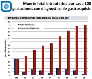 1
Normal
Muerte fetal intrauterina por cada 100
gestaciones con diagnostico de gastrosquisis.
 