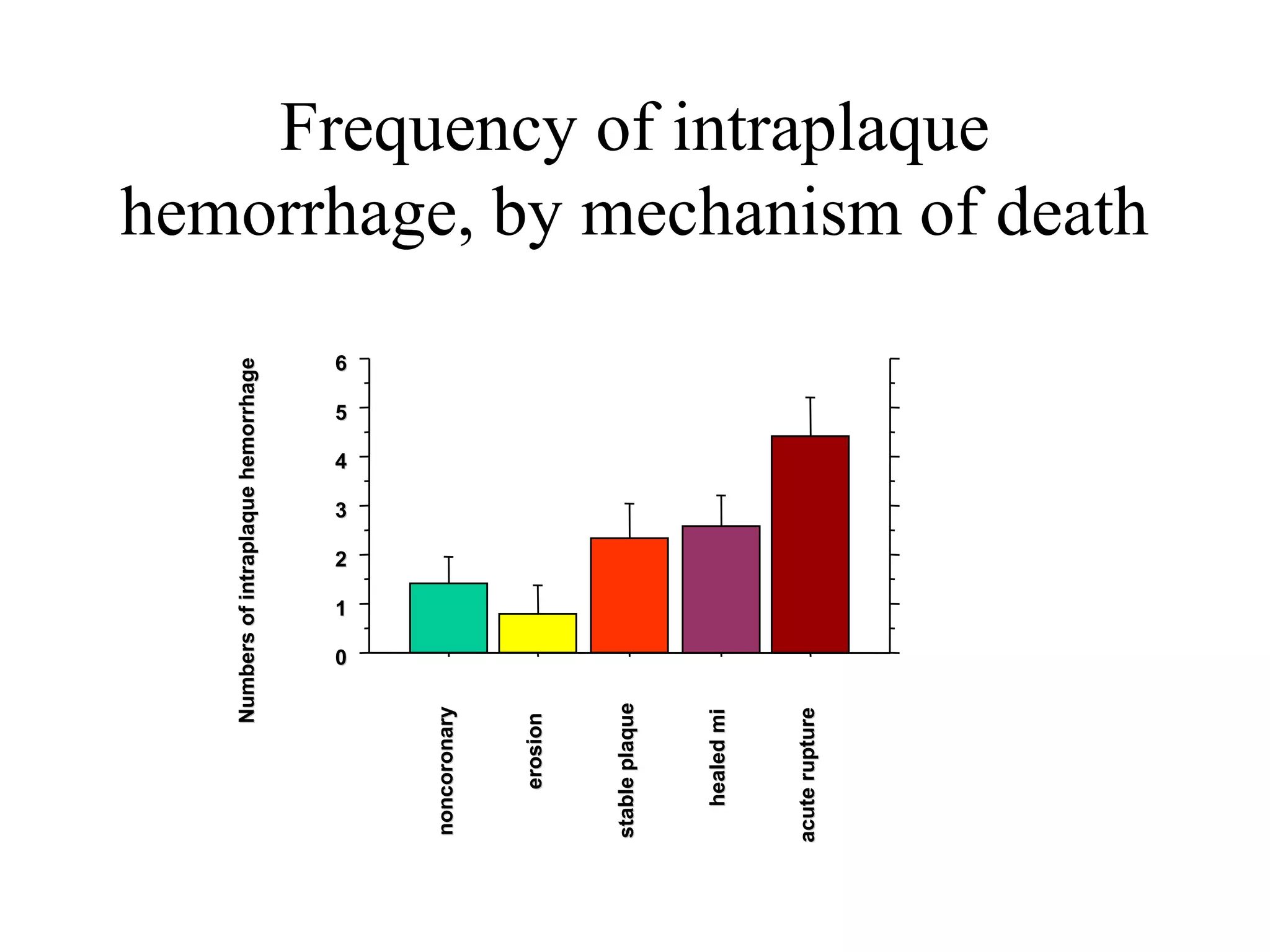 Frequency of intraplaque
hemorrhage, by mechanism of deathNumbersofintraplaquehemorrhageNumbersofintraplaquehemorrhage
noncoronarynoncoronary
erosionerosion
stableplaquestableplaque
healedmihealedmi
acuteruptureacuterupture
00
11
22
33
44
55
66
 
