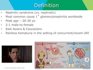 © 2016 Virginia Mason Medical Center
Definition
• Nephritic syndrome (vs. nephrotic)
• Most common cause 1˚ glomerulonephritis worldwide
• Peak age – 20-30 yo
• 2:1 male-to-female
• East Asians & Caucasians
• Painless hematuria in the setting of concurrent/recent URI
3
 