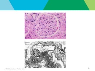 © 2016 Virginia Mason Medical Center 8
right lung nodules and infiltrates
 