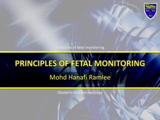 PRINCIPLES OF FETAL MONITORING MohdHanafiRamlee 