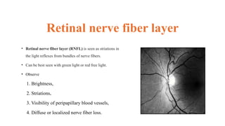 Comprehensive Evaluation of the Optic Nerve Head in Ophthalmology | PPTX