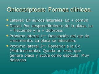 Onicocriptosis: Formas clínicas.Onicocriptosis: Formas clínicas.
 Lateral: En surcos laterales. La + comúnLateral: En surcos laterales. La + común
 Distal: Por desprendimiento de la placa. LaDistal: Por desprendimiento de la placa. La
– frecuente y la + dolorosa.– frecuente y la + dolorosa.
 Próximo lateral 1Próximo lateral 1ariaaria
: Desviación del eje de: Desviación del eje de
crecimiento. La placa se lateraliza.crecimiento. La placa se lateraliza.
 Próximo lateral 2Próximo lateral 2ariaaria
: Posterior a la Cx: Posterior a la Cx
(Matricectomia). Queda un resto que(Matricectomia). Queda un resto que
genera placa y actúa como espícula. Muygenera placa y actúa como espícula. Muy
dolorosodoloroso
 