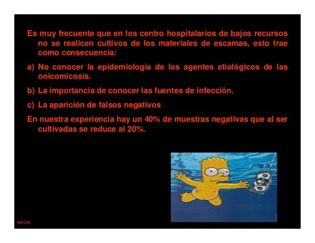 Como por el aceite acético sanar el hongo sobre las uñas