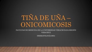TIÑA DE UÑA –
ONICOMICOSIS
FACULTAD DE MEDICINA DE LA UNIVERSIDAD VERACRUZANA REGIÓN
VERACRUZ
DERMATOLOGÍA #904
 