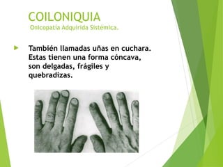 onicopat-as-que-podr-an-afectar-los-pies-ppt