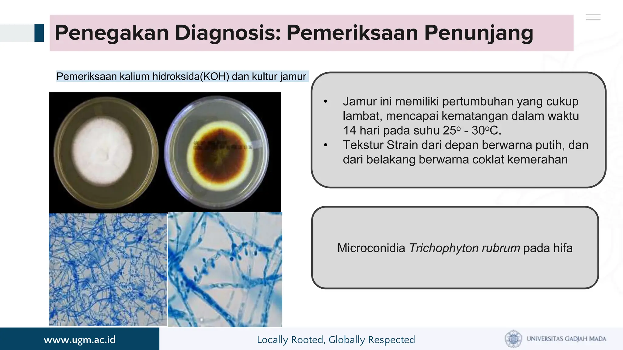 Onikomikosis otomikosis otomikosis otominosis | PPT