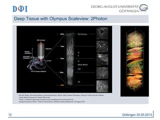 12 
Deep Tissue with Olympus Scaleview: 2Photon 
Göttingen 30.05.2013 
Hiroshi Hama, Hiroshi Kurokawa, Hiroyuki Kawano, Ryoko Ando,Tomomi Shimogori, Hisayori Noda, Kiyoko Fukami, 
Asako Sakaue-Sawano & Atsushi Miyawaki 
"Scale: a chemical approach for fluorescence imaging and reconstruction of 
transparent mouse brain," Nature Neuroscience, advance online publication, 30 August 2011 
 