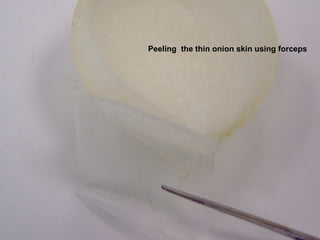 Peeling  the thin onion skin using forceps 