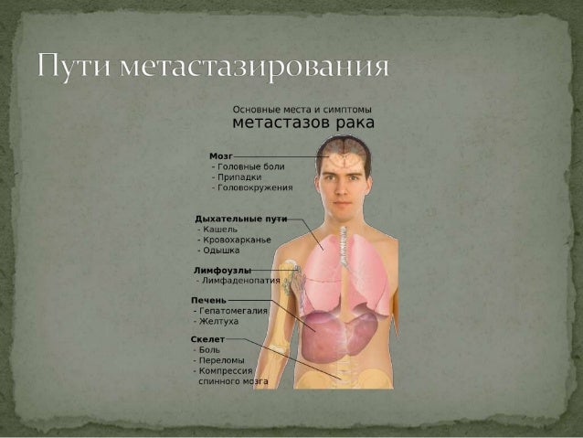 марихуана при онкологических заболеваниях марихуана при онкологических заболеваниях