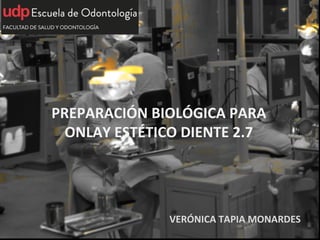 PREPARACIÓN	
  BIOLÓGICA	
  PARA	
  
ONLAY	
  ESTÉTICO	
  DIENTE	
  2.7	
  
VERÓNICA	
  TAPIA	
  MONARDES	
  
 