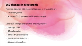 ECG changes in Myocarditis
The most common ECG abnormalities seen in myocarditis are:
• Sinus tachycardia
• Non-specific ST segment and T waves changes
Other ECG changes are variable, and may include:
• Prolonged QRS
• QT prolongation
• Diffuse T wave inversion
• Ventricular arrhythmias
• AV conduction defects
 