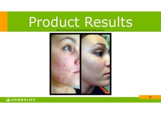 !22
Product ResultsThese results are not typical and individual results may vary
 