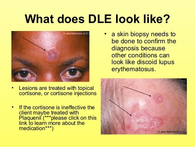 Where can you find online pictures of skin lesions?