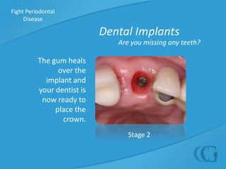 Initial TherapyMy Periodontal Summary Score  My Risk Level Dr. Galler’s AssessmentTREATING +PERIODONTAL _______________ My Treatment PlanDISEASERemember!In order to achieve long-term periodontal health there must be ongoing and active  supervision of your periodontal health.  This requires a commitment from yourself, your dentist and your periodontist.Healthy MouthPeriodontitis
