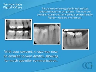 We Now HaveDigital X-RaysThis amazing technology significantly reduces radiation exposure to our patients.  The x-rays are available instantly and this method is environmentally friendly – requiring no chemicals.With your consent, x-rays may now be emailed to your dentist, allowing for much speedier communication.