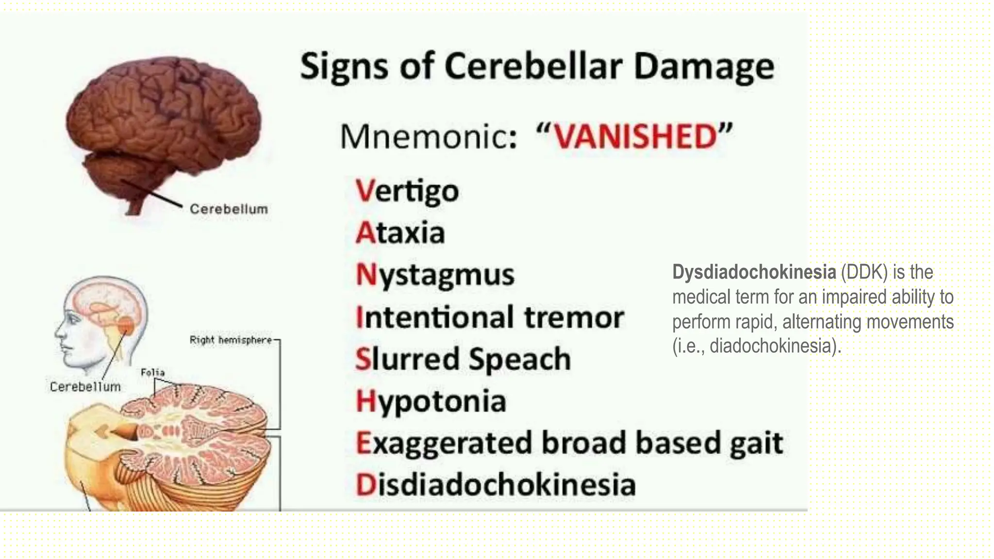 Dysdiadochokinesia (DDK) is the
medical term for an impaired ability to
perform rapid, alternating movements
(i.e., diadochokinesia).
 