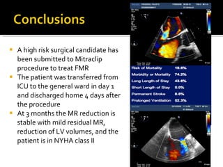 A high risk surgical candidate has been submitted to Mitraclip procedure to treat FMR The patient was transferred from ICU to the general ward in day 1 and discharged home 4 days after the procedure At 3 months the MR reduction is stable with mild residual MR, reduction of LV volumes, and the patient is in NYHA class II 