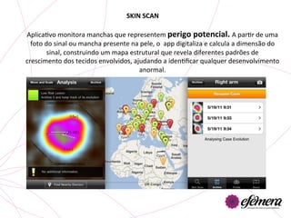 SKIN	
  SCAN	
  

AplicaUvo	
  monitora	
  manchas	
  que	
  representem	
  perigo	
  potencial.	
  A	
  parUr	
  de	
  uma	
  
  foto	
  do	
  sinal	
  ou	
  mancha	
  presente	
  na	
  pele,	
  o	
  	
  app	
  digitaliza	
  e	
  calcula	
  a	
  dimensão	
  do	
  
           sinal,	
  construindo	
  um	
  mapa	
  estrutural	
  que	
  revela	
  diferentes	
  padrões	
  de	
  
crescimento	
  dos	
  tecidos	
  envolvidos,	
  ajudando	
  a	
  idenUﬁcar	
  qualquer	
  desenvolvimento	
  
                                                         anormal.	
  
 