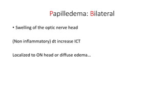 Papilledema: Bilateral
• Swelling of the optic nerve head
(Non inflammatory) dt increase ICT
Localized to ON head or diffuse edema…
 