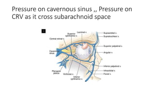 Pressure on cavernous sinus ,, Pressure on
CRV as it cross subarachnoid space
 