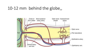10-12 mm behind the globe,,
 