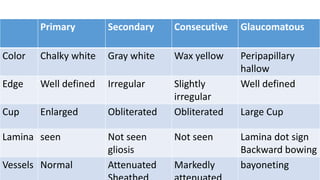 Primary Secondary Consecutive Glaucomatous
Color Chalky white Gray white Wax yellow Peripapillary
hallow
Edge Well defined Irregular Slightly
irregular
Well defined
Cup Enlarged Obliterated Obliterated Large Cup
Lamina seen Not seen
gliosis
Not seen Lamina dot sign
Backward bowing
Vessels Normal Attenuated Markedly bayoneting
 