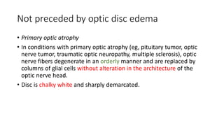 Not preceded by optic disc edema
• Primary optic atrophy
• In conditions with primary optic atrophy (eg, pituitary tumor, optic
nerve tumor, traumatic optic neuropathy, multiple sclerosis), optic
nerve fibers degenerate in an orderly manner and are replaced by
columns of glial cells without alteration in the architecture of the
optic nerve head.
• Disc is chalky white and sharply demarcated.
 